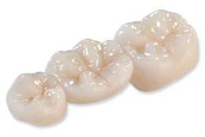 Zirconia Crowns by Dr. Kenneth Chae