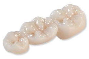 Zirconia Crowns by Dr. Kenneth Chae Zirconia Crowns by Dr. Kenneth Chae
